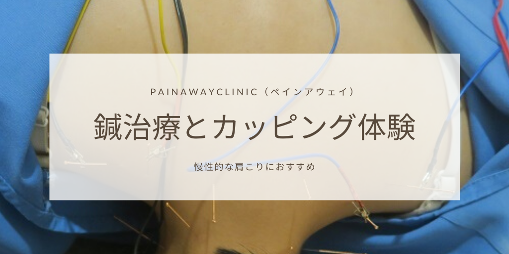 慢性的な肩こりに鍼治療とカッピングを ペインアウェイ で受けてきました Pr